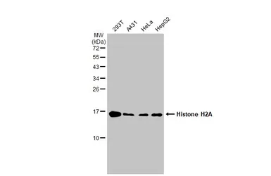 Anti-Histone H2A antibody used in Western Blot (WB). GTX129418