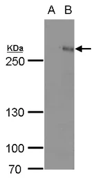 Anti-ARID1A antibody used in Western Blot (WB). GTX129432