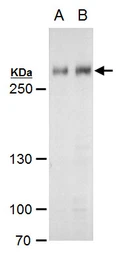 Anti-ARID1A antibody used in Western Blot (WB). GTX129433