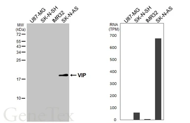 Anti-VIP antibody used in Western Blot (WB). GTX129461