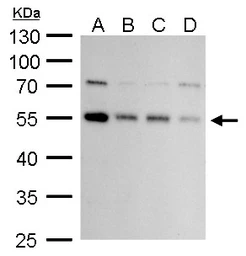 Anti-ATG4C antibody used in Western Blot (WB). GTX129488