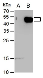 Anti-E2F5 antibody used in Western Blot (WB). GTX129491