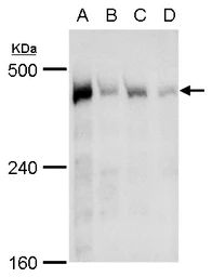 Anti-TRRAP antibody used in Western Blot (WB). GTX129507