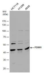 Anti-FOXH1 antibody used in Western Blot (WB). GTX129508