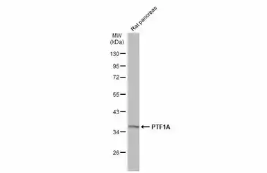 Anti-PTF1A antibody used in Western Blot (WB). GTX129525