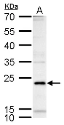 Anti-ICOS antibody used in Western Blot (WB). GTX129570