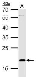 Anti-TSLP antibody used in Western Blot (WB). GTX129571
