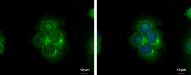 Anti-S100A9 antibody used in Immunocytochemistry/ Immunofluorescence (ICC/IF). GTX129575