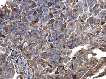 Anti-S100A9 antibody used in IHC (Paraffin sections) (IHC-P). GTX129575