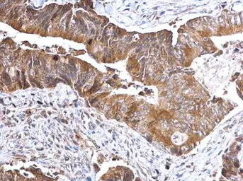 Anti-TSLP antibody used in IHC (Paraffin sections) (IHC-P). GTX129591