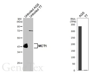 Anti-MCT1 antibody used in Western Blot (WB). GTX129599