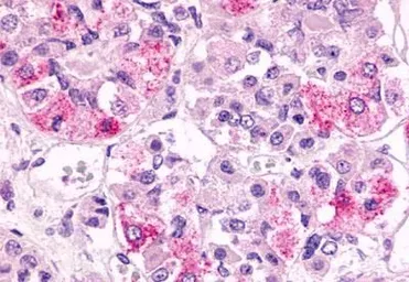 Anti-GPR81 antibody used in IHC (Paraffin sections) (IHC-P). GTX12960