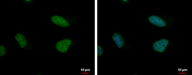 Anti-Timeless antibody used in Immunocytochemistry/ Immunofluorescence (ICC/IF). GTX129604