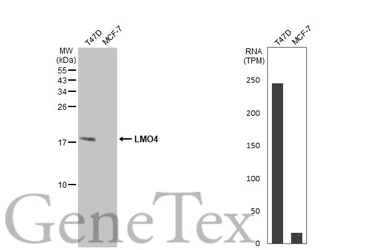 Anti-LMO4 antibody used in Western Blot (WB). GTX129616