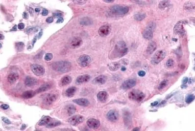 Anti-ERR alpha antibody used in IHC (Paraffin sections) (IHC-P). GTX12985