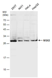 Anti-MSX2 antibody used in Western Blot (WB). GTX129870