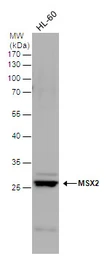 Anti-MSX2 antibody used in Western Blot (WB). GTX129870