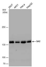Anti-SA2 antibody used in Western Blot (WB). GTX129876