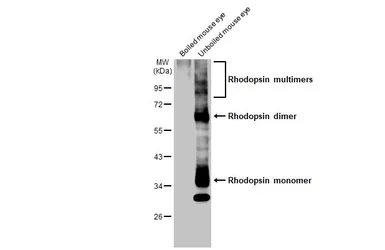 Anti-Rhodopsin antibody used in Western Blot (WB). GTX129910