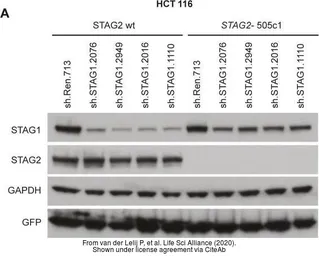 Anti-SA1 antibody used in Western Blot (WB). GTX129912