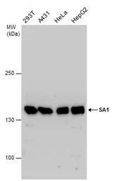 Anti-SA1 antibody used in Western Blot (WB). GTX129912