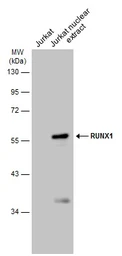 Anti-RUNX1 antibody used in Western Blot (WB). GTX129953