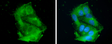 Anti-Apolipoprotein CIII antibody used in Immunocytochemistry/ Immunofluorescence (ICC/IF). GTX129994