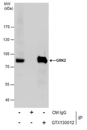 Anti-GRK2 antibody used in Immunoprecipitation (IP). GTX130012