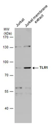 Anti-TLR1 antibody used in Western Blot (WB). GTX130079