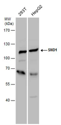 Anti-SND1 antibody used in Western Blot (WB). GTX130135