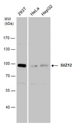 Anti-SUZ12 antibody used in Western Blot (WB). GTX130179