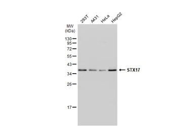 Anti-STX17 antibody used in Western Blot (WB). GTX130212