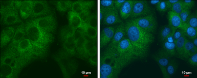 Anti-RPL32 antibody used in Immunocytochemistry/ Immunofluorescence (ICC/IF). GTX130214