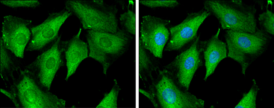 Anti-Tropomodulin 1 antibody used in Immunocytochemistry/ Immunofluorescence (ICC/IF). GTX130237