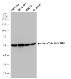 Anti-beta Tubulin 3/ Tuj1 antibody used in Western Blot (WB). GTX130245