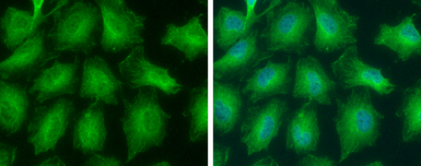 Anti-GNPDA2 antibody used in Immunocytochemistry/ Immunofluorescence (ICC/IF). GTX130289
