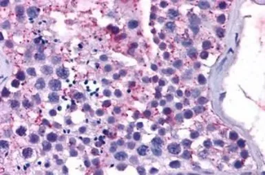 Anti-MAS1 antibody used in IHC (Paraffin sections) (IHC-P). GTX13032