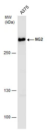 Anti-NG2 antibody used in Western Blot (WB). GTX130401