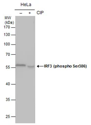 Anti-IRF3 (phospho Ser386) antibody used in Western Blot (WB). GTX130422