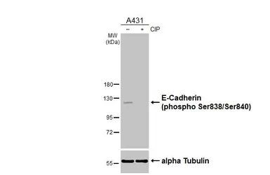 Anti-E-Cadherin (phospho Ser838/840) antibody used in Western Blot (WB). GTX130427