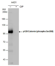 Anti-p120 Catenin (phospho Ser268) antibody used in Western Blot (WB). GTX130428