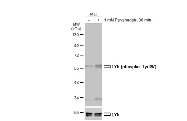Anti-LYN (phospho Tyr397) antibody used in Western Blot (WB). GTX130454