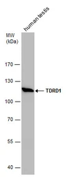 Anti-TDRD1 antibody used in Western Blot (WB). GTX130485
