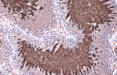 Anti-ACE antibody used in IHC (Paraffin sections) (IHC-P). GTX130534