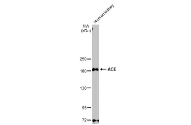 Anti-ACE antibody used in Western Blot (WB). GTX130534