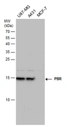 Anti-PBR antibody used in Western Blot (WB). GTX130550