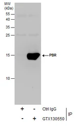 Anti-PBR antibody used in Immunoprecipitation (IP). GTX130550