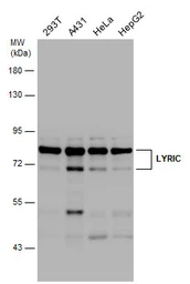 Anti-LYRIC antibody used in Western Blot (WB). GTX130679