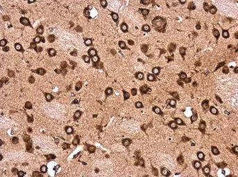Anti-LYRIC antibody used in IHC (Paraffin sections) (IHC-P). GTX130679
