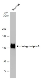 Anti-Integrin alpha 5 antibody used in Western Blot (WB). GTX130705